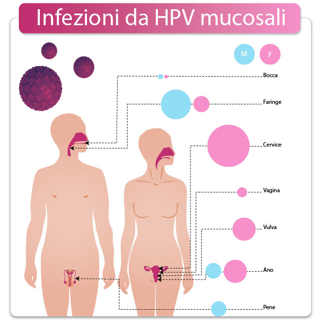 Infezioni da HPV mucosali
